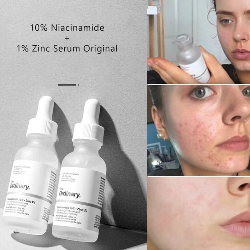 Pore-Perfecting Niacinamide & Zinc Glow Serum